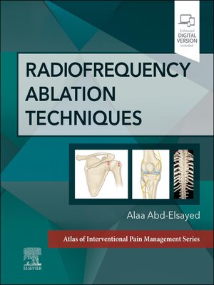 cover image of Radiofrequency Ablation Techniques